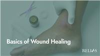 Basics of Wound Healing
