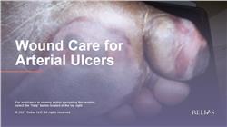Wound Care for Arterial Ulcers