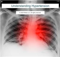 About Hypertension